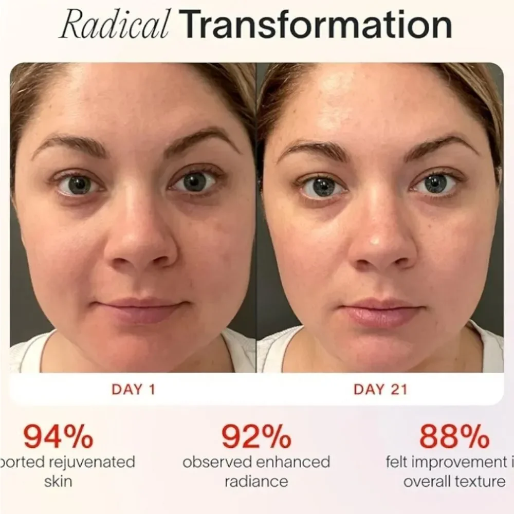 Solawave Advanced 4-In-1 Skincare‎ Wand & Activating Serum Kit